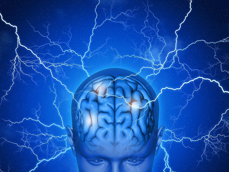 Tudo que você precisa saber sobre epilepsia | Doutor Cerebro - Neurologista